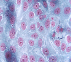 細(xì)胞侵襲、轉(zhuǎn)染